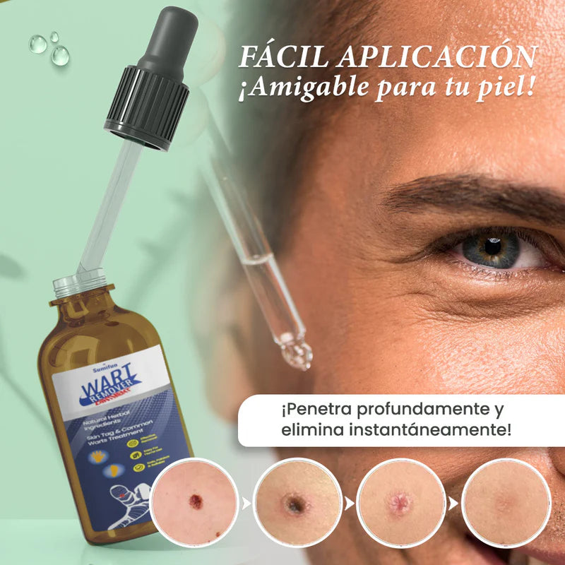 Wart Remover - Removedor de verrugas y manchas