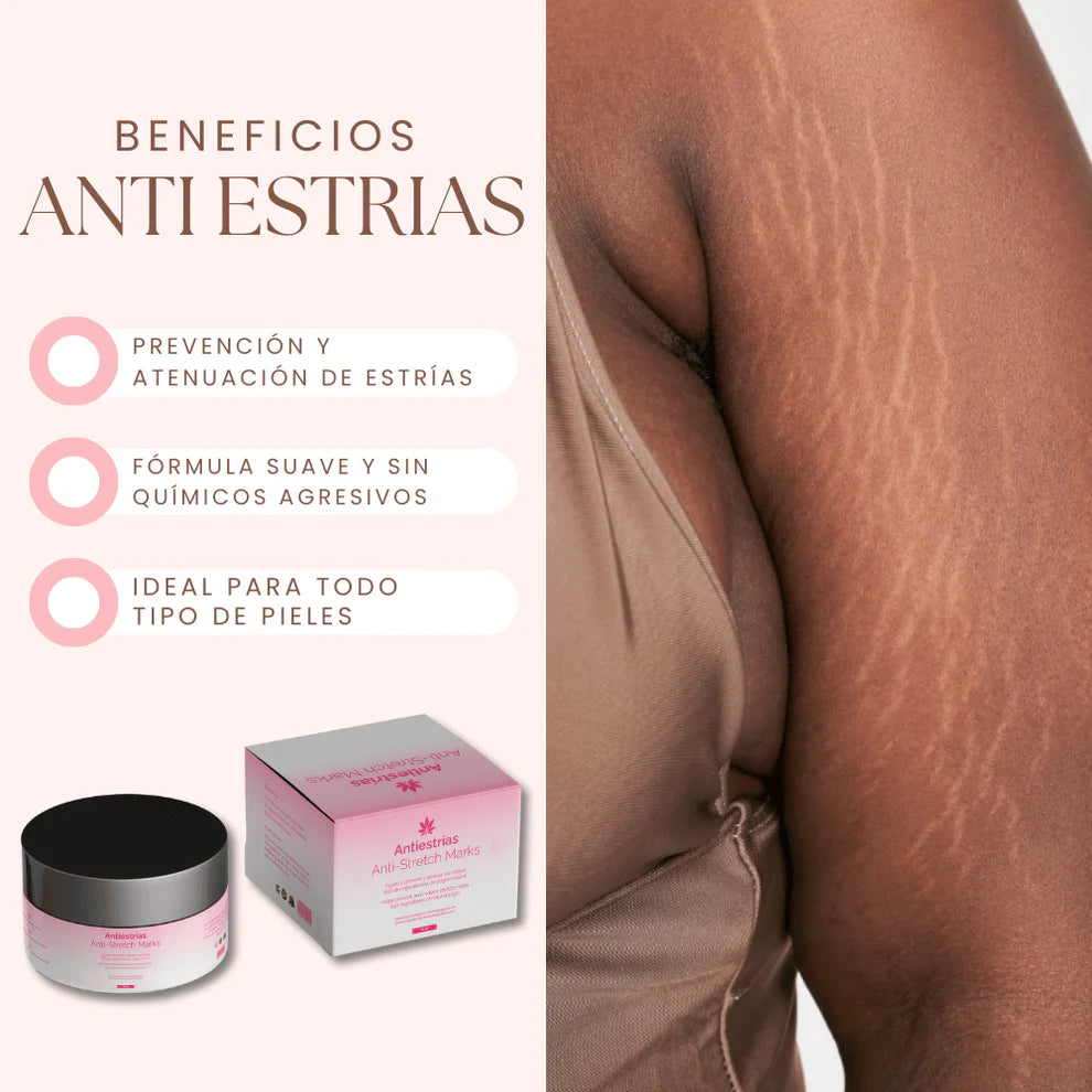 Crema Antiestrias