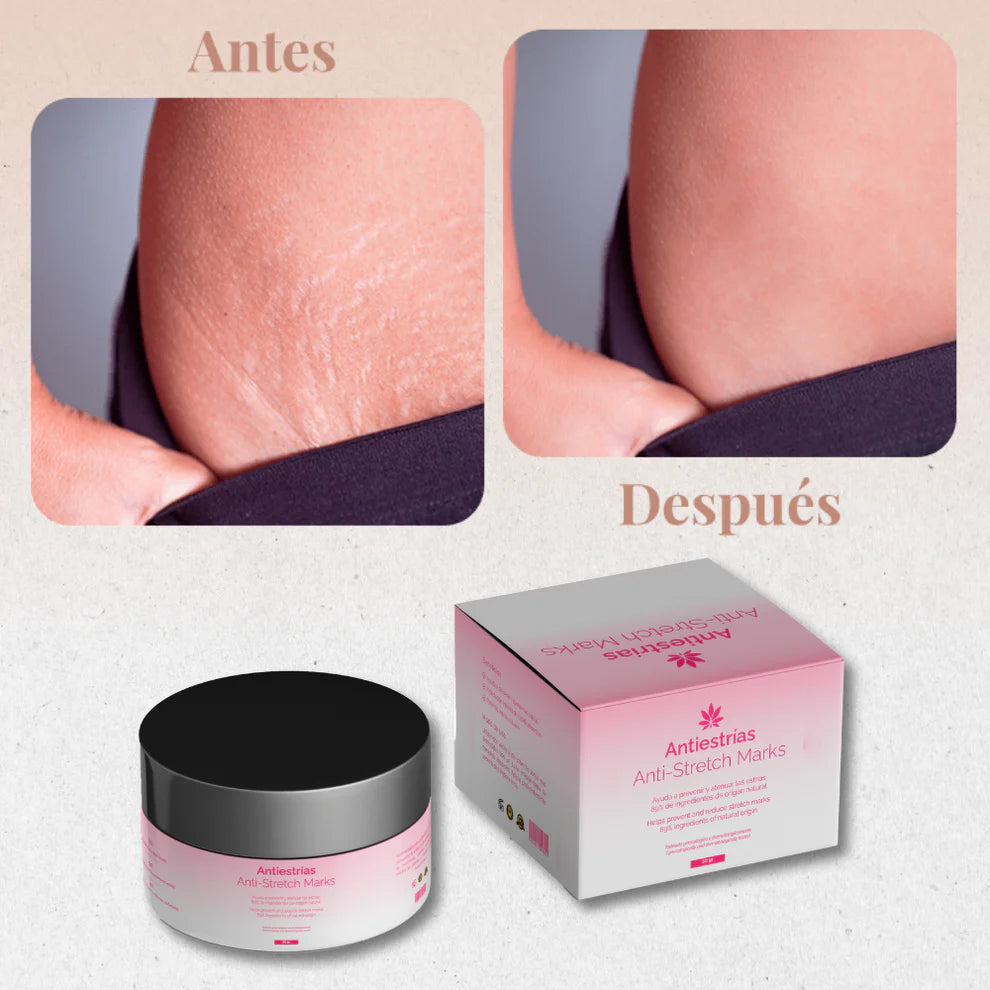 Crema Antiestrias